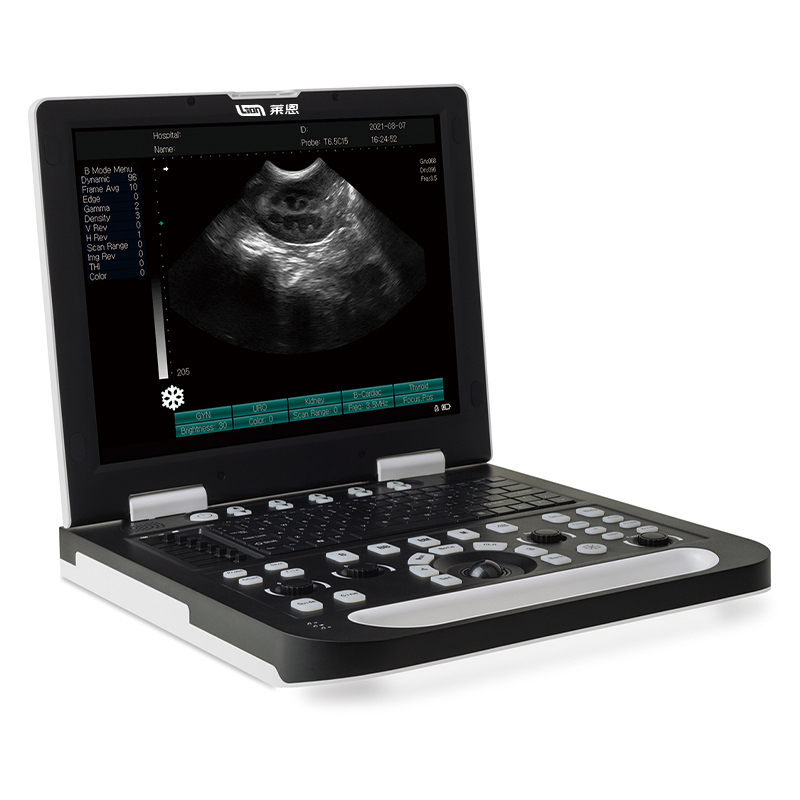 Multi-Function Full Digital HD USG Machine Human Ultrasonic Desktop Ultrasound System