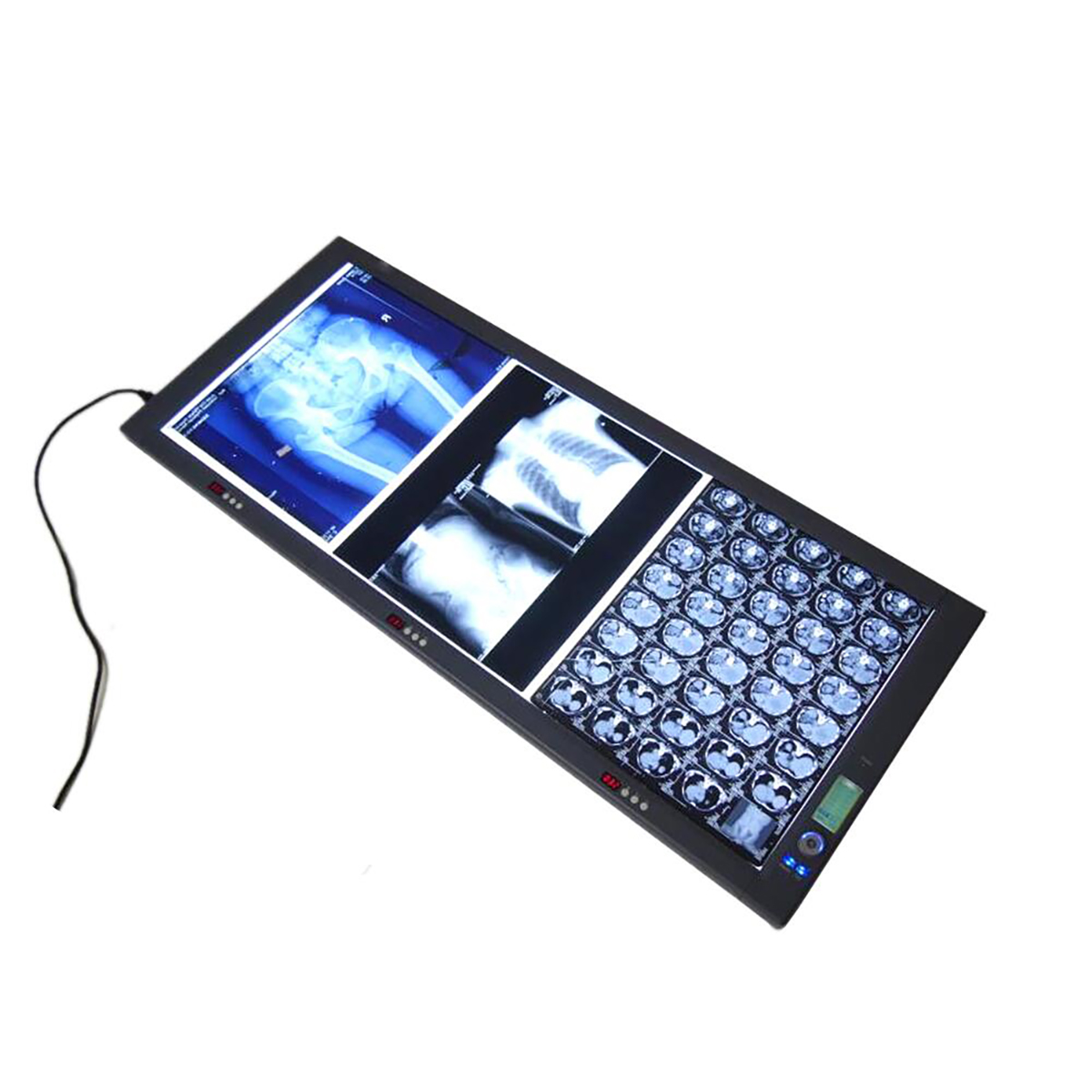 Medical Viewing Lamp Triptych Viewing Light Double Viewing Light Led X-Ray Film Viewer Led Panel
