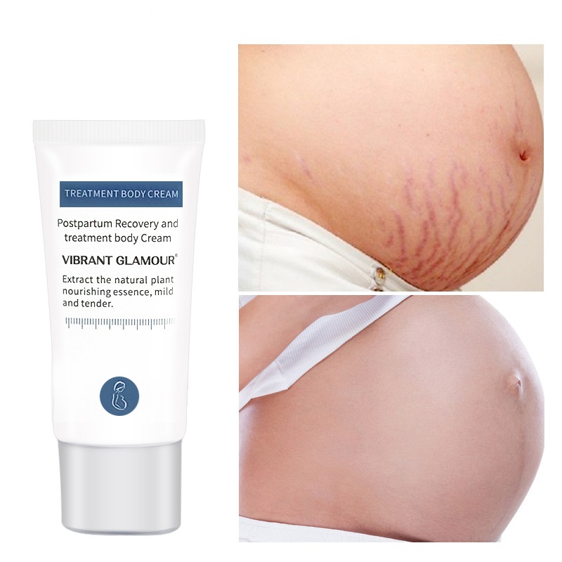 Hot Sale Private Label Best Natural Organic Postpartum Pregnancy Stretch Marks Removal Cream