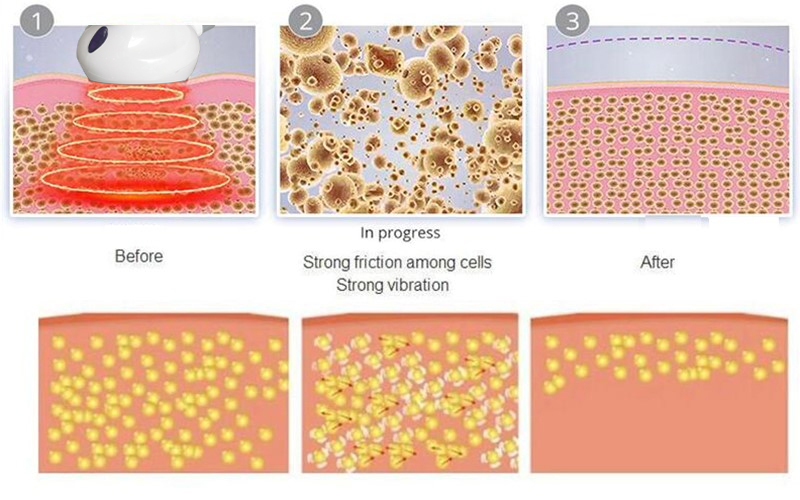 2022 Cellulite Vacuum Roller Massage Machine 6 In 1 Cavitation Machine 80k hz Radio Frequency Vepashaping Machine Price