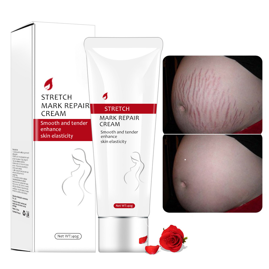 Best Effective Stretch Mark Removal Cream Mango Pregnancy For Marks Private Label Anti Lanbena Repair Stretch Mark Cream