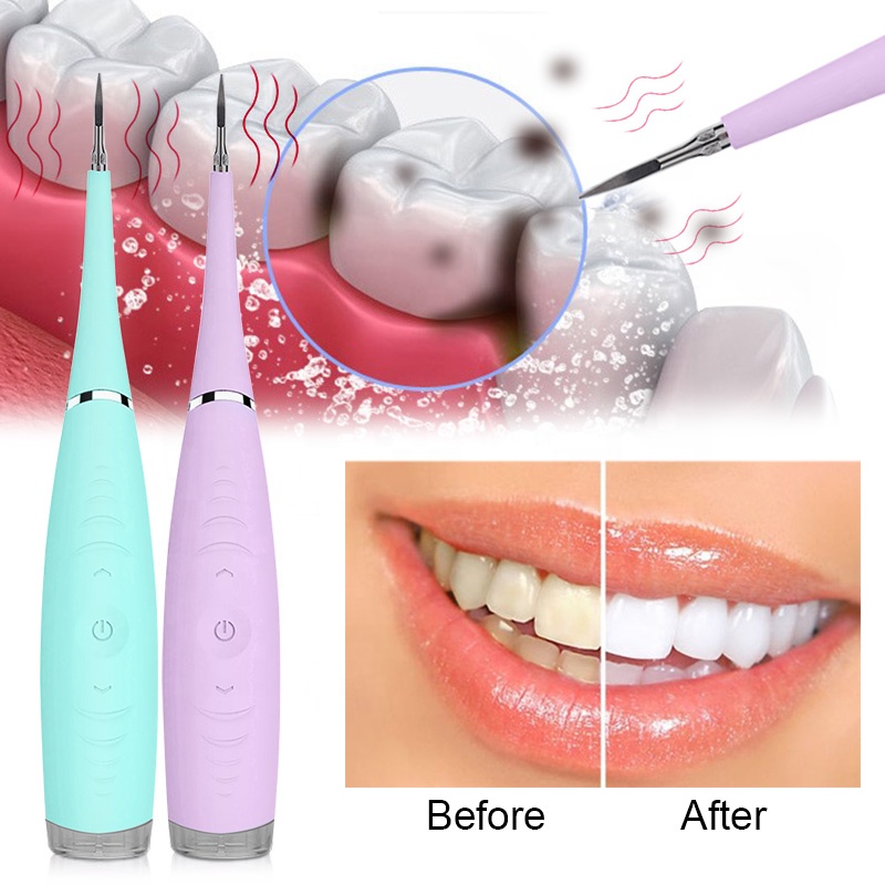 Electric Ultrasonic Dental Scaler Sonic Tooth Calculus Remover Teeth Cleaner Stains Tartar Removal Tool Teeth Whitening Oral