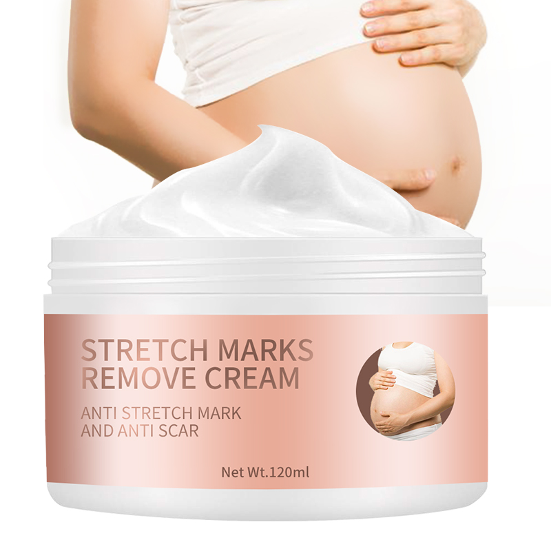 OEM Private Label natural organic Face Anti Scar Repair Body Stretch Mark Removal Cream