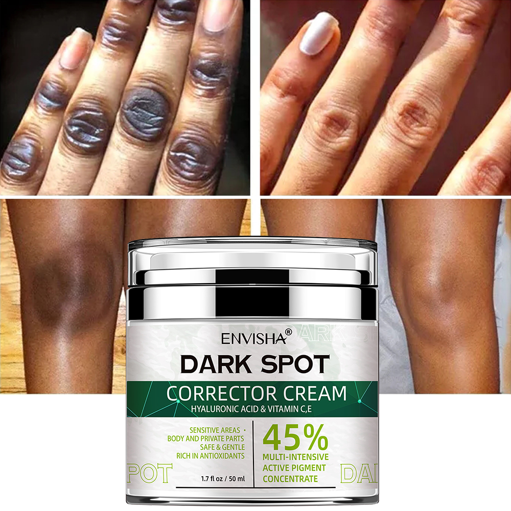 Korean Natural Vegan Neck Facial Vitamin C Acne Pimples Dark Spot Strong Corrector Remover Cream