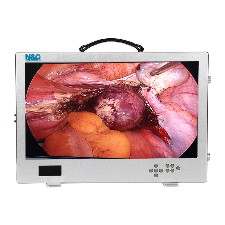 Full Hd 1080p Medical Endoscope Camera System Integrated Medical Endoscope Camera System