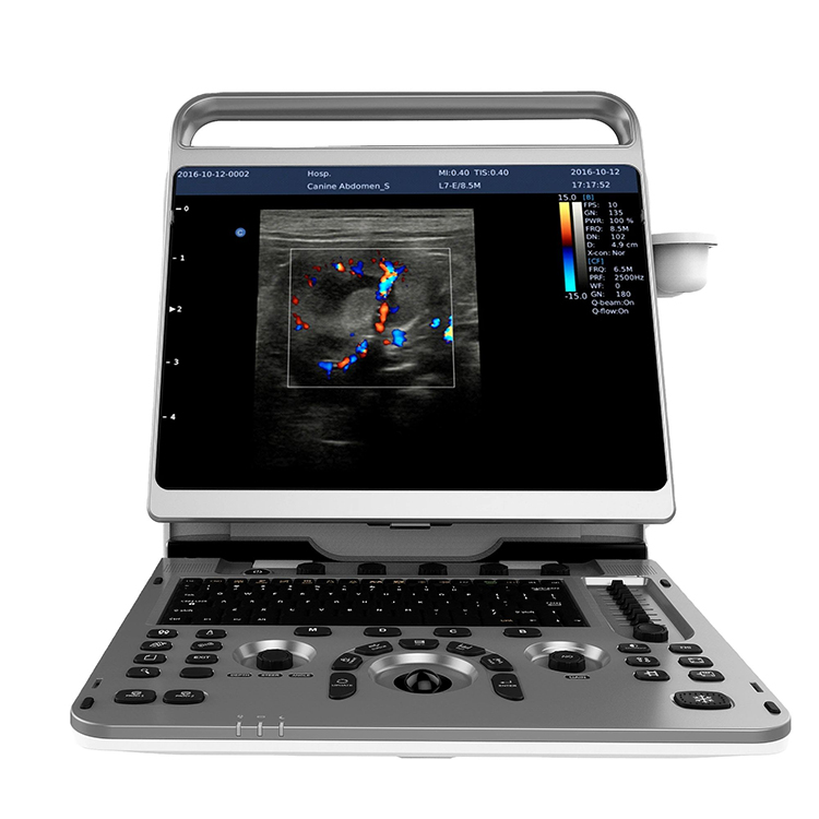 4D 5D Portable Color Doppler Human Cardiovascular Echo Machine Chison EBit 30 Convex Linear Ultrasound Gynecology