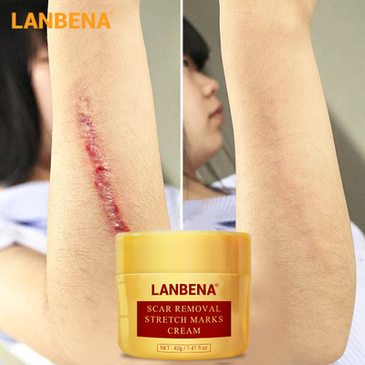 LANBENA крем для удаления шрамов растяжек