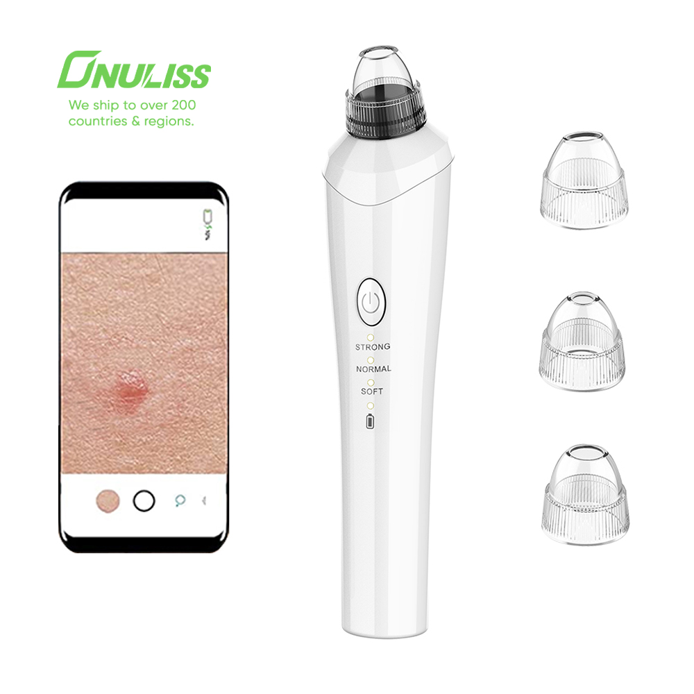 Visible Facial Pore Cleanser Black Head Remover Vacuum Blackhead Remover with Camera