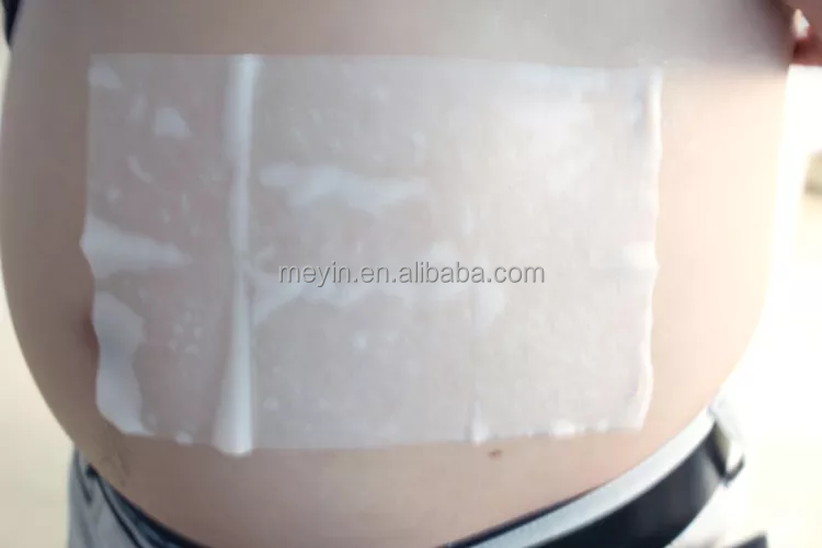 antifreeze membranes criolipolisis cryolipolysis antifreeze membrane