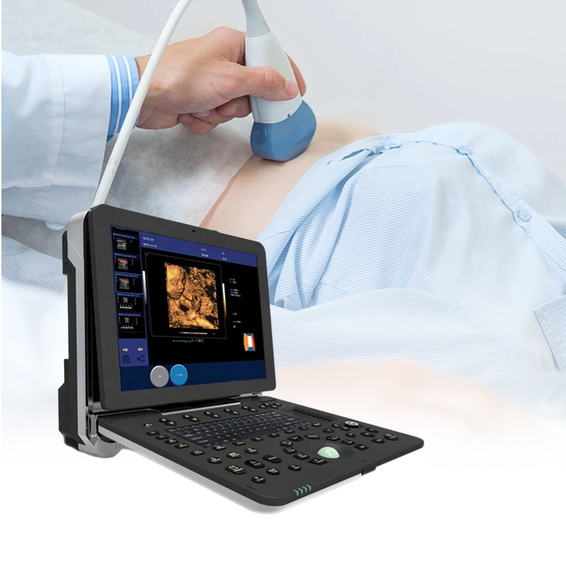 Ultrasound Full Digital Ultrasonic Diagnostic Imaging System B/W Portable Ultrasound Machine