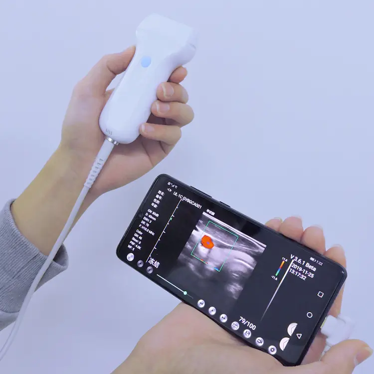 Factory Directly Selling For Wifi USB Connection Handheld Ultrasound Probe Compatible With IPhone/Android/ Computer