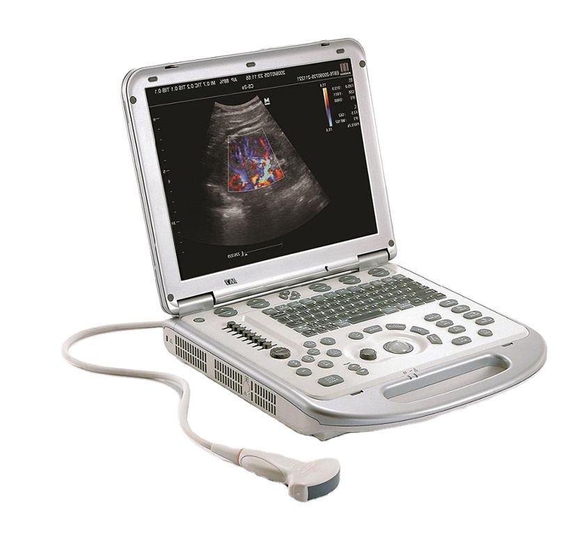 ge vscan extend with dual probe diagnostic ultrasound system Ergonomics
