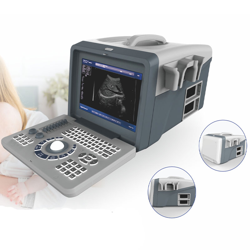 3d edan, ультразвуковая машина, цена 4d, ультразвуковая машина ob zoncare, ультразвуковая машина