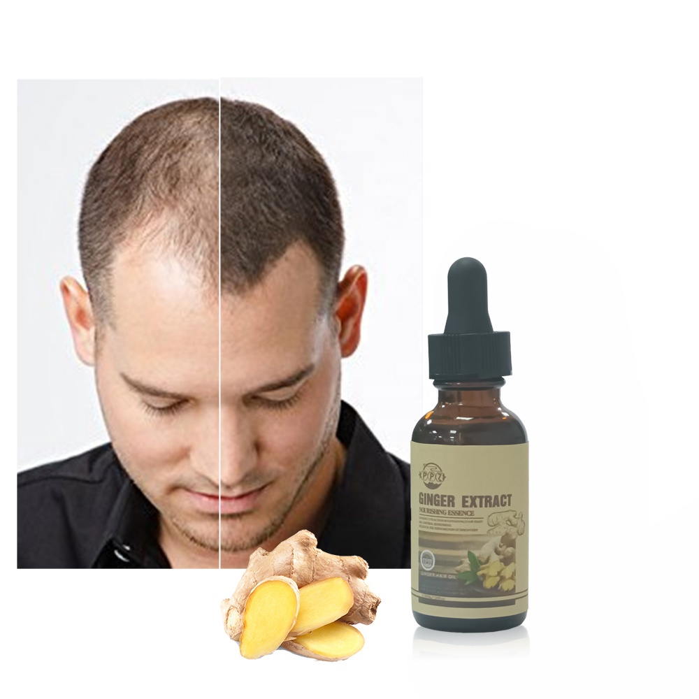 OEM 30ml Ginger Hair Oil For Men Hair Growth Oil Organic Custom Ginger Oil for Hair Regrowth