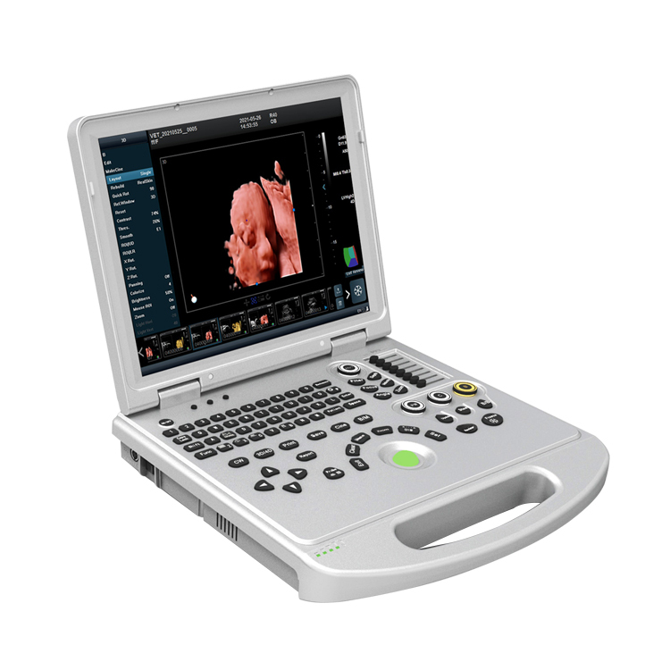 Color ultrasonic diagnostic apparatus portable ultrasound machine