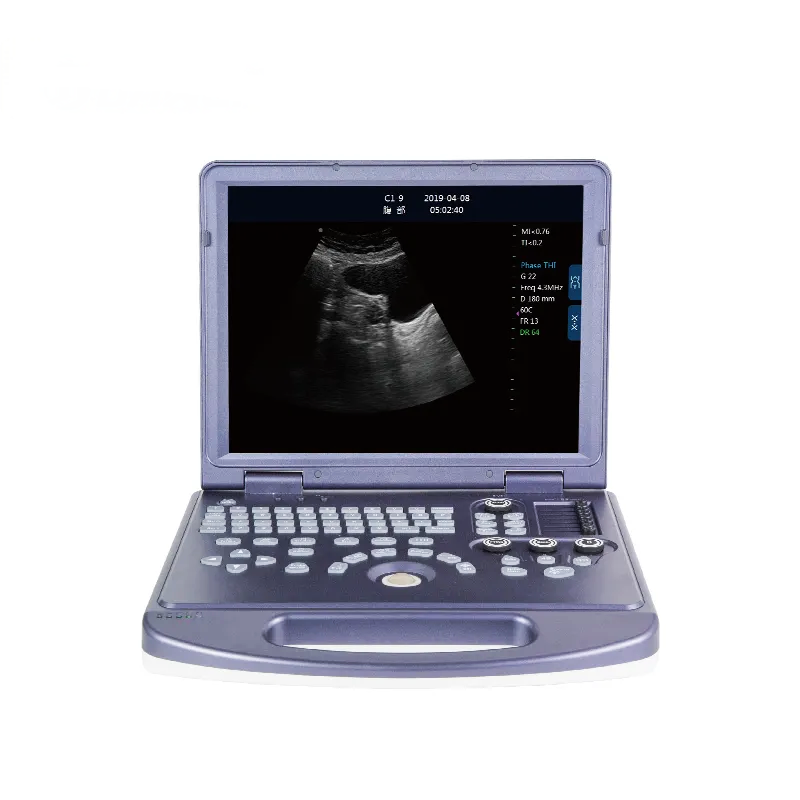 Full digital Black and White ultrasonic diagnostic system for clinic use