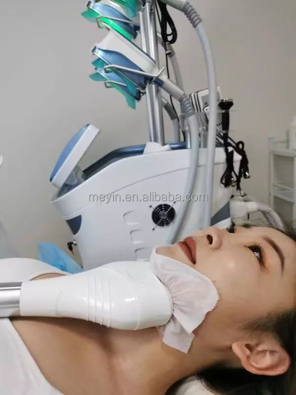 antifreeze membranes criolipolisis cryolipolysis antifreeze membrane