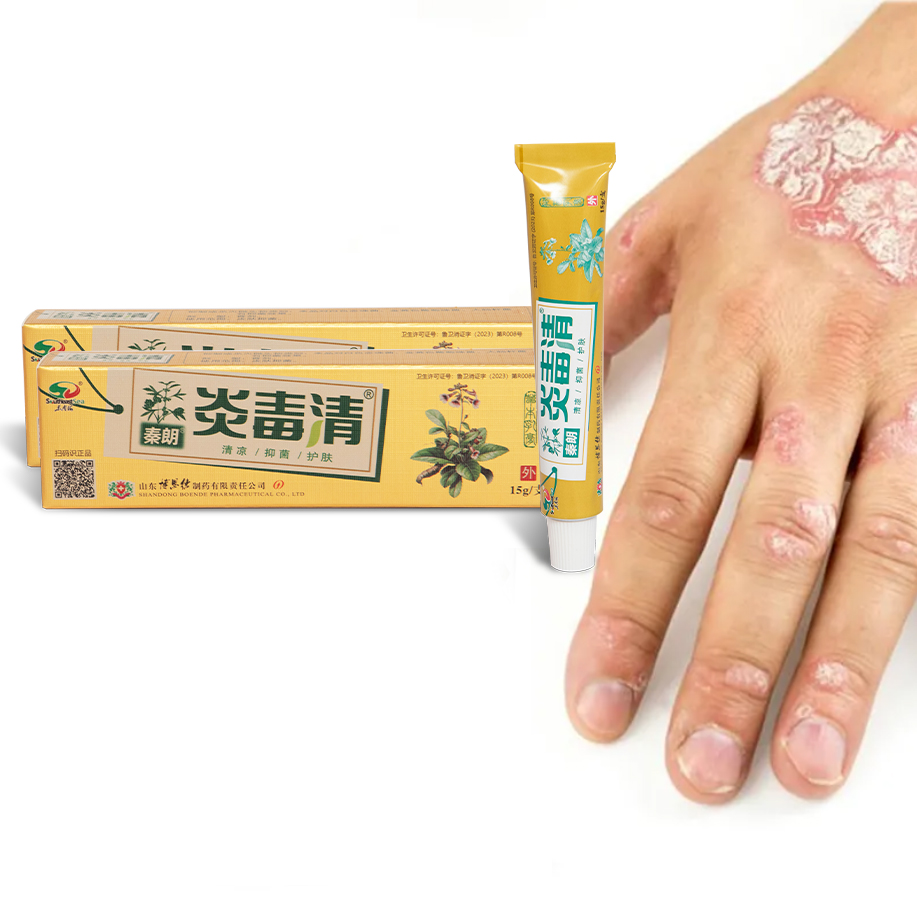 Qinlang Yanduqing Herbal Cream Topical Cream Psoriasis Ointment Effectively Body Care for Psoriasis for Adults