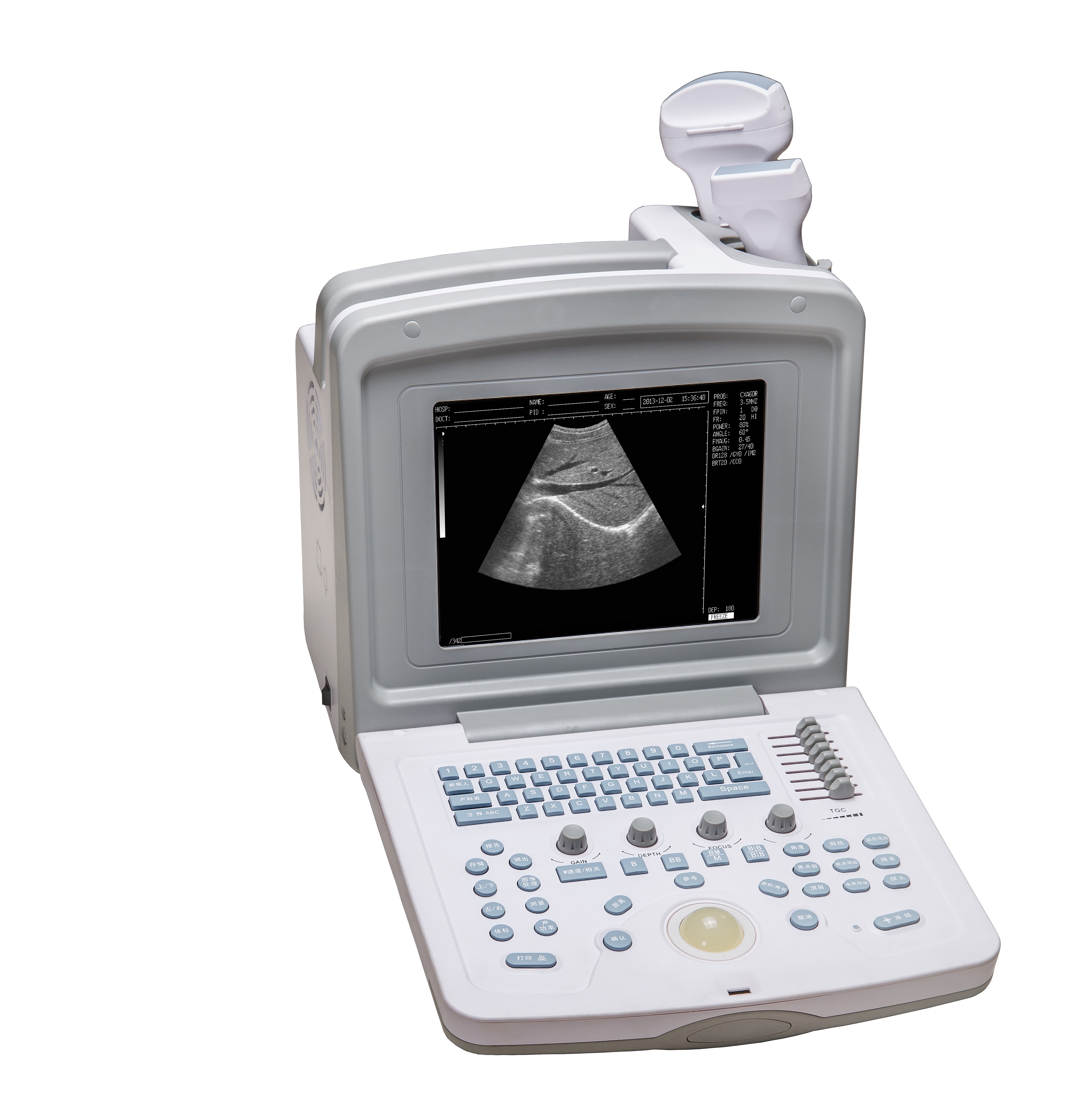medical ultrasound instruments mobile pregnancy scanner ultrasound machine portable doppler ultrasound scanner for human