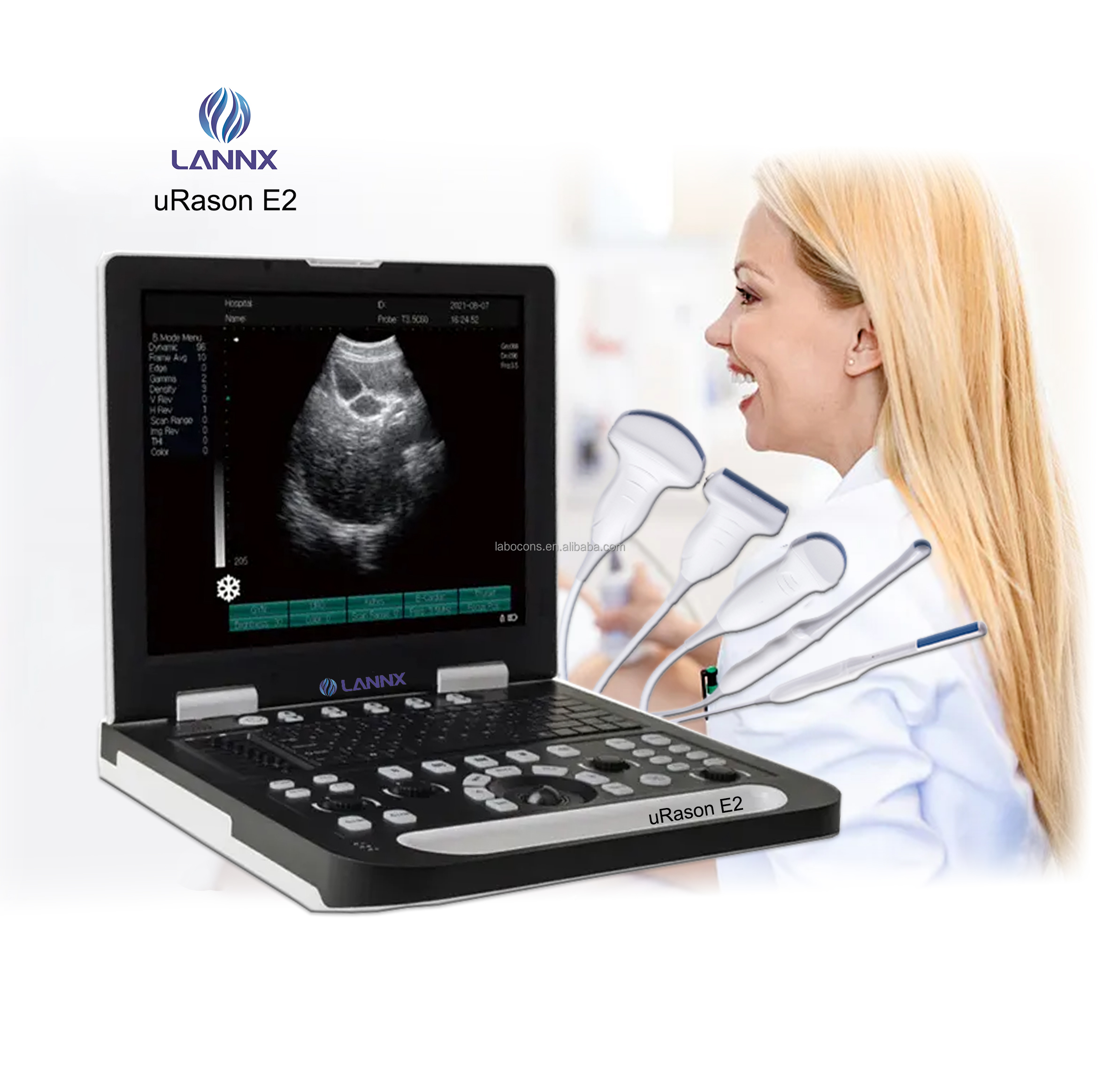 LANNX uRason E2 B/W Portable Ultrasound Machine Excellent medical 3D USG Full Digital Ultrasonic Diagnostic Imaging System