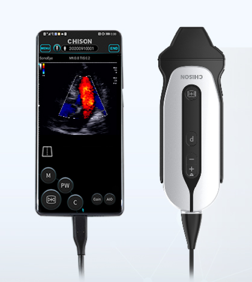 Durable Metal and Plastic Handheld Ultrasound System with Electric Power Source Portable Electronic Ultrasonic Equipment