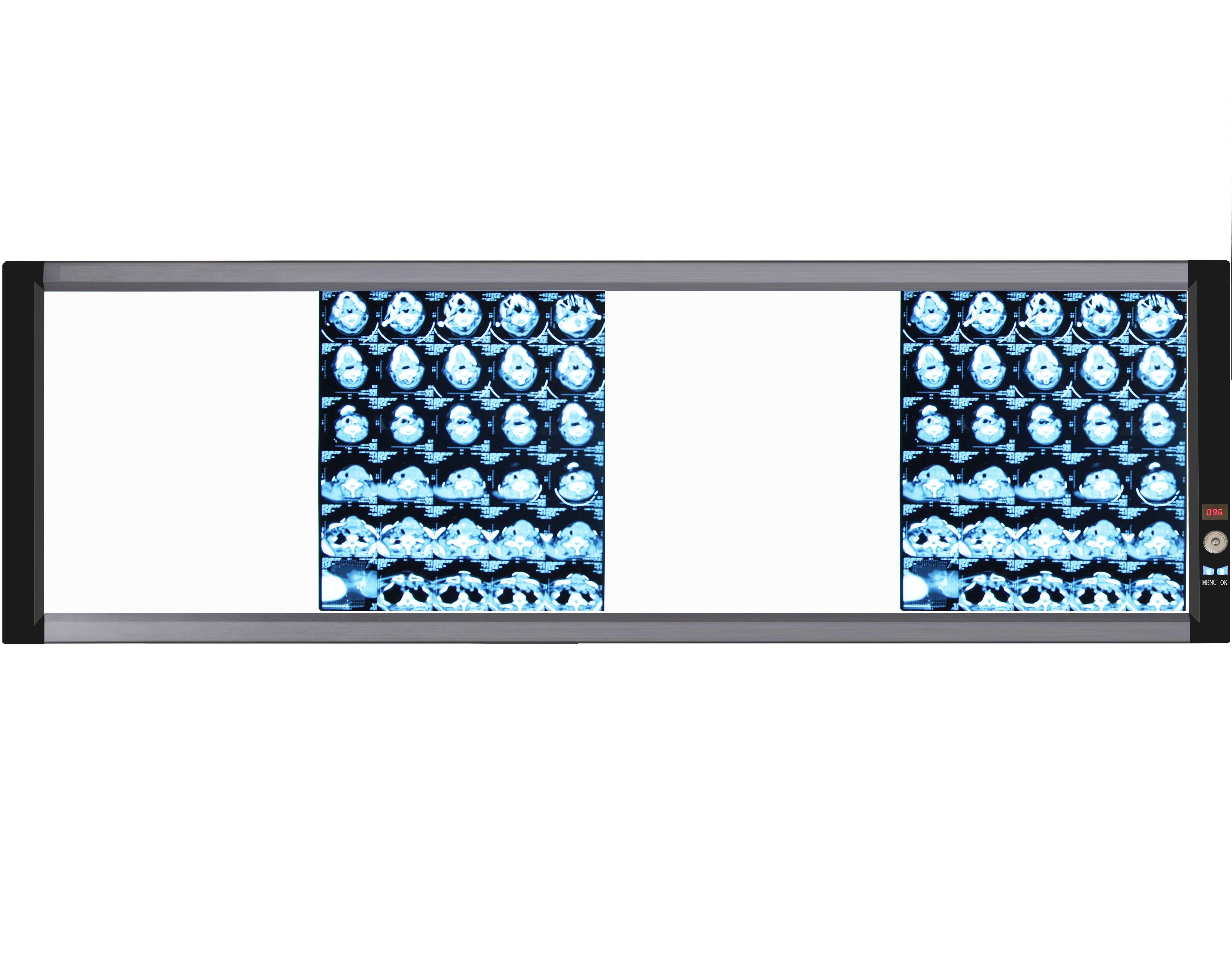 Ultra slim LED hospital quadruple union x-ray film negatoscope
