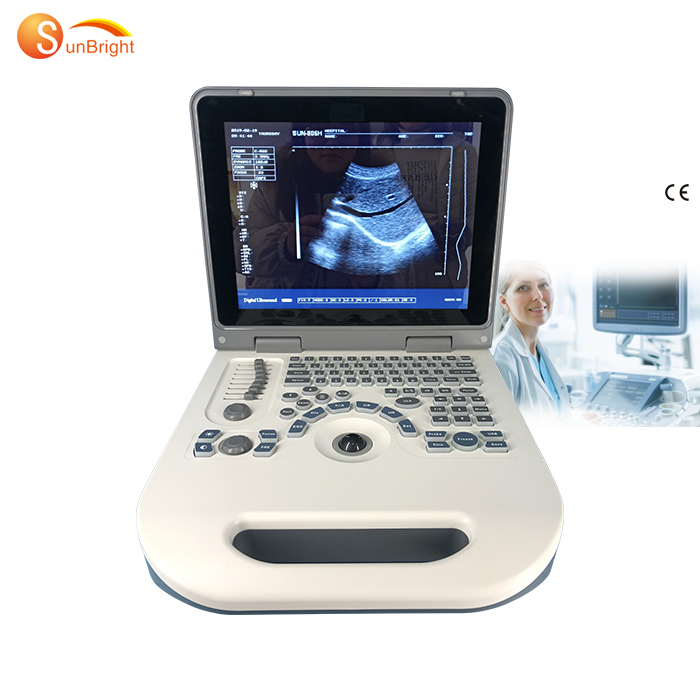 Ultrasonic Optical Electronic Equipment Portable 2D Medical Ultrasound Instrument SUN-806G