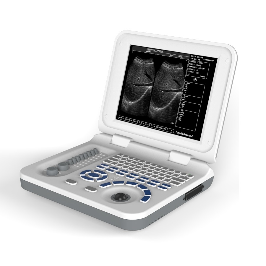 YJ-X30 electronic diagnostic devices system full digital LED portable ultrasound Hospital Ultrasound Machine