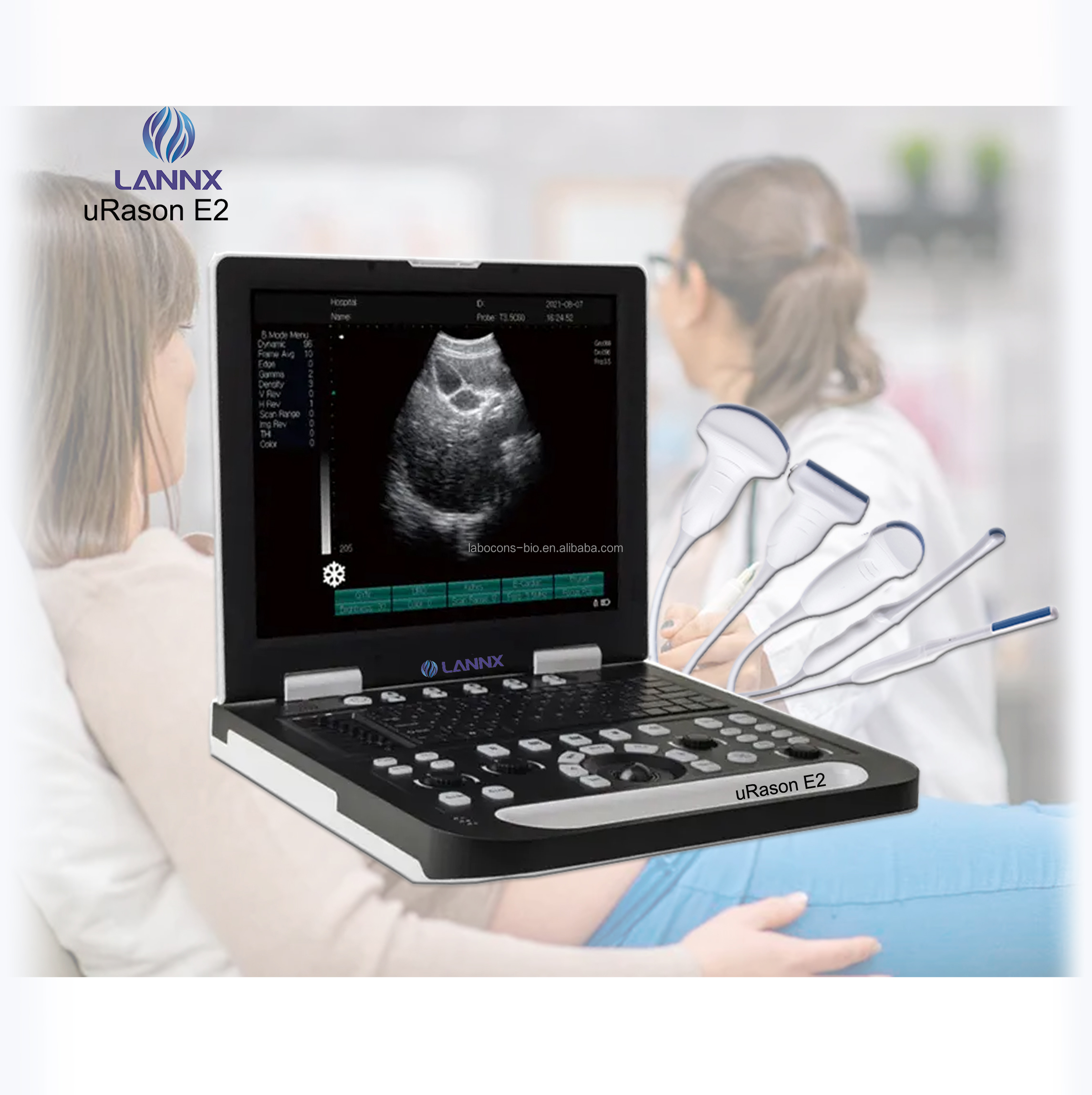 LANNX uRason E2 Professional B/W Portable Ultrasound Machine Full Digital Ultrasonic Diagnostic Imaging System Ultrasound