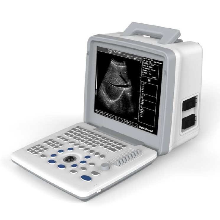 Manufacturer Of Good Quality LED Portable handheld Ultrasound , LED Portable Ultrasound Scanner