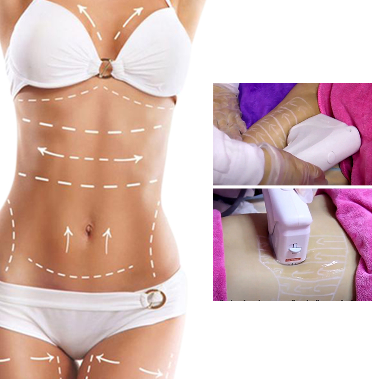 hifu 4d ultrasound anti-wrinkle 4d ultrasound hifu machine factory sale 2021