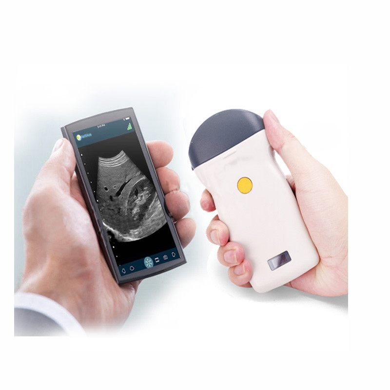 Electronic Array Scanning B B/M Color PW PDI Mini Wireless Probe Type Portable Medical Ultrasound Machine