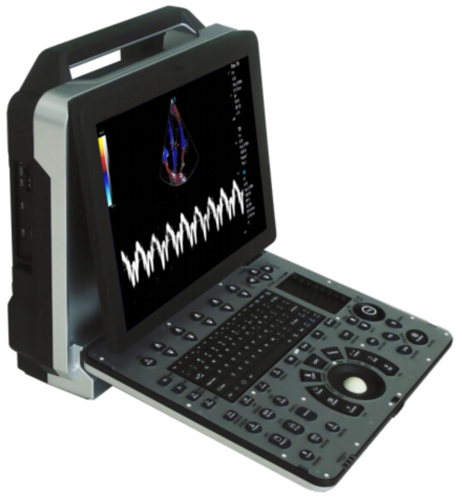 YF-US-01Portable Medical Ultrasound Diagnostic System
