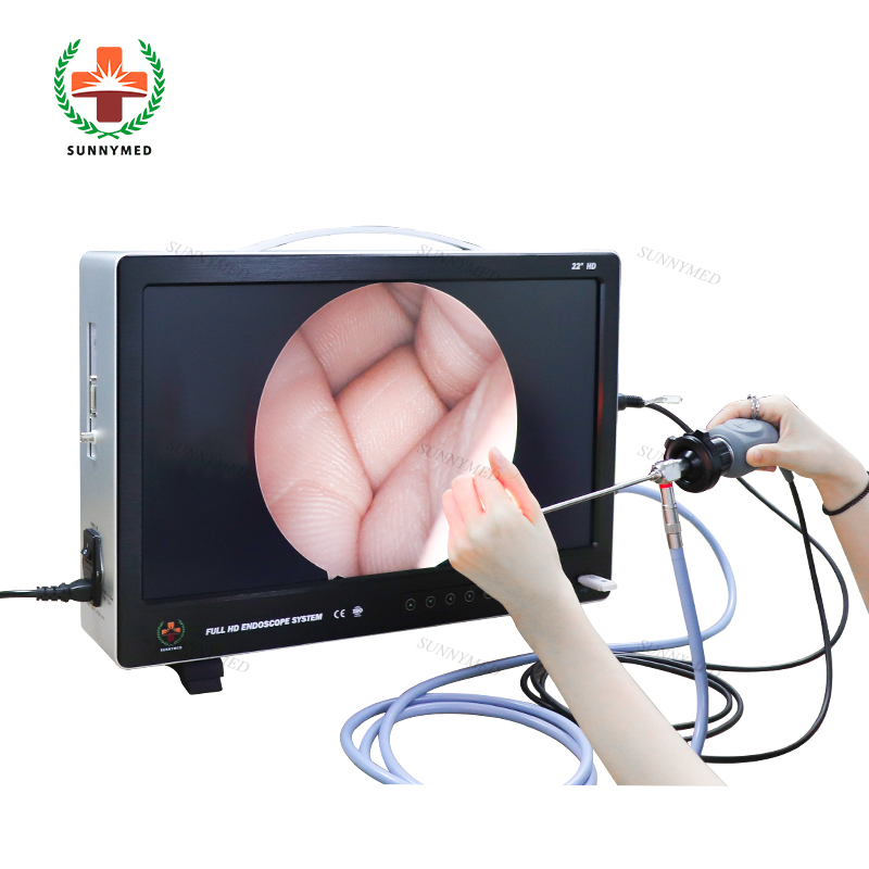 Sunnymed SY-PS050 камеры и светодиодным источником света кабель Профессиональный эндоскоп