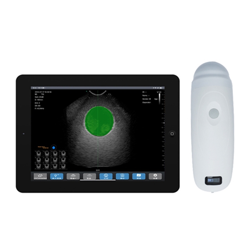 New upgrade Ai precision algorithm bladder urine volume detector handheld 4D wireless ultrasound bladder scanner