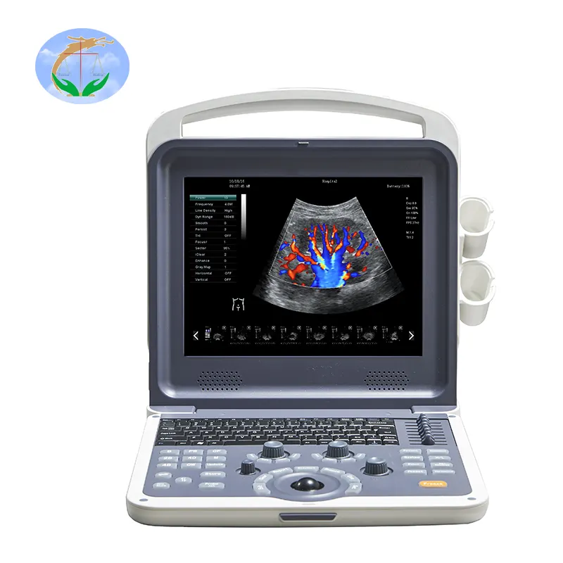 Hot selling 4D color doppler ultrasound equipment portable ultrasonic diagnostic devices