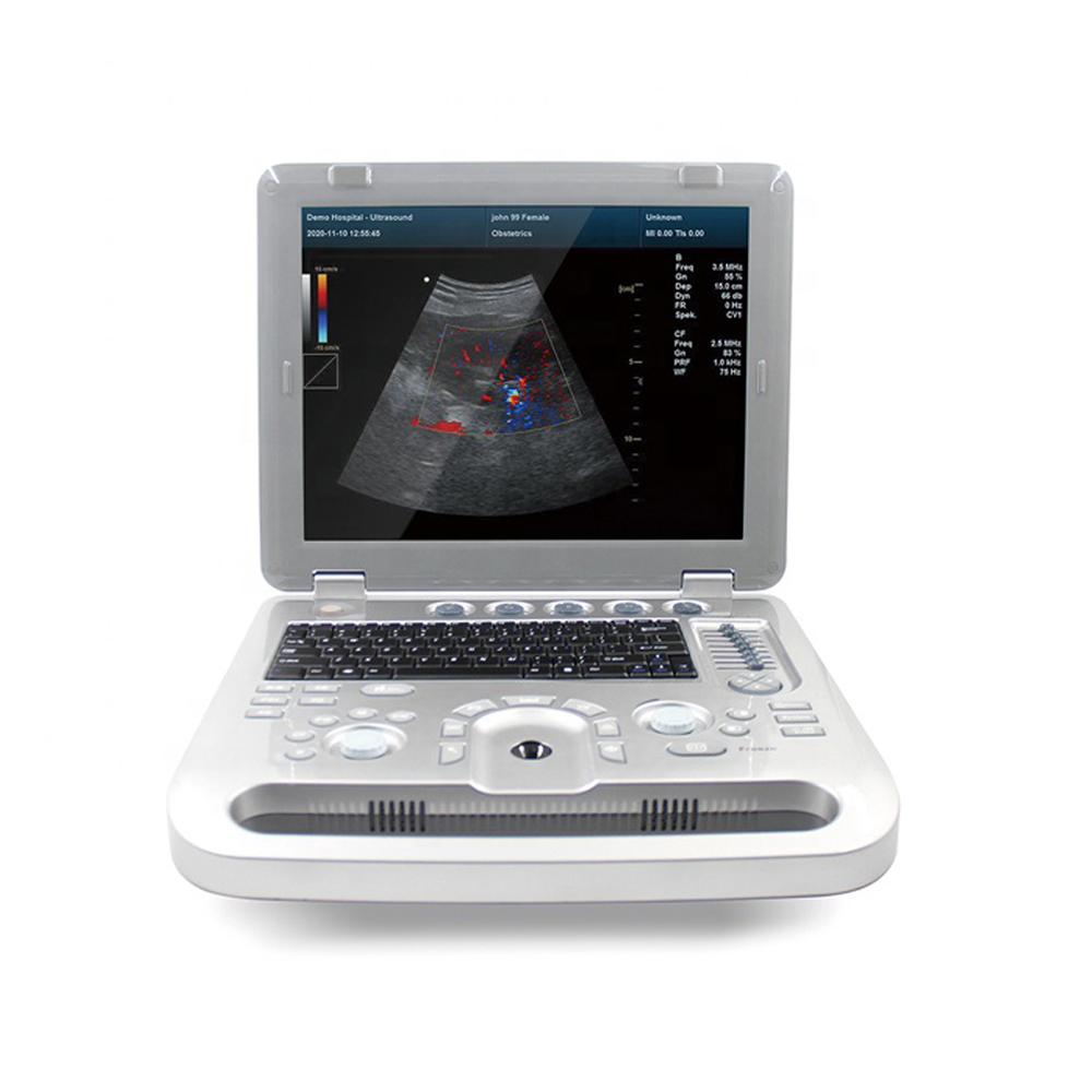 CMS1700A Portable Color Doppler Sonography Ultrasound Scanner Machine