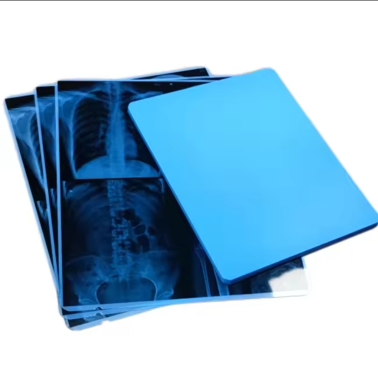 Digital Printing Inkjet X-ray Film A4 for medical equipment