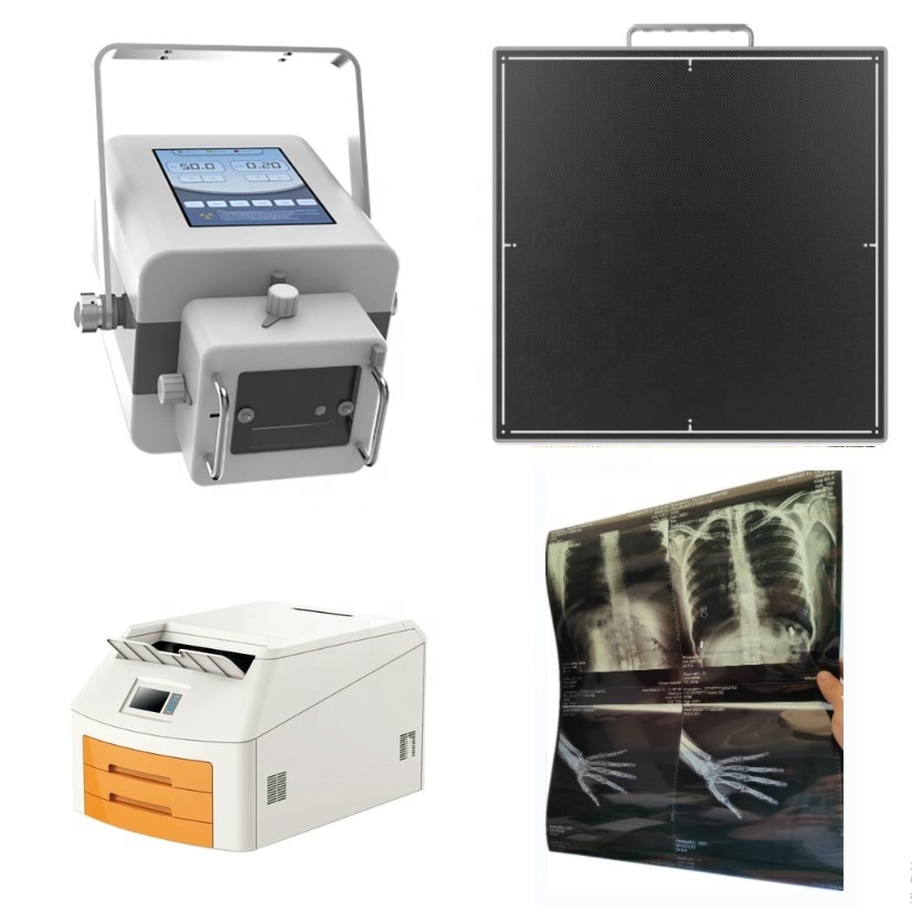 High Frequency x ray machine medical device radiological x-ray