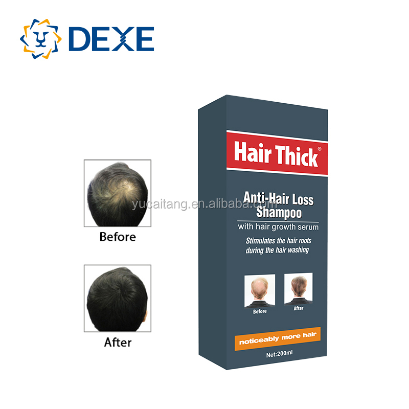Arabic anti hair loss shampoo and anti lotion set