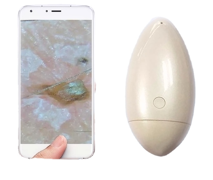 skin analyzer portable skin analysis camera digital dermatoscope manufacturer priceMini Wireless WiFi Skin Scalp Analyzer