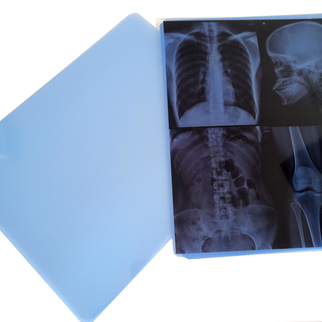 Blue Base LED X-Ray Film 100ma Portable Manual Reprint Machine for PET X-Ray Medical Radiology Equipment & Accessories
