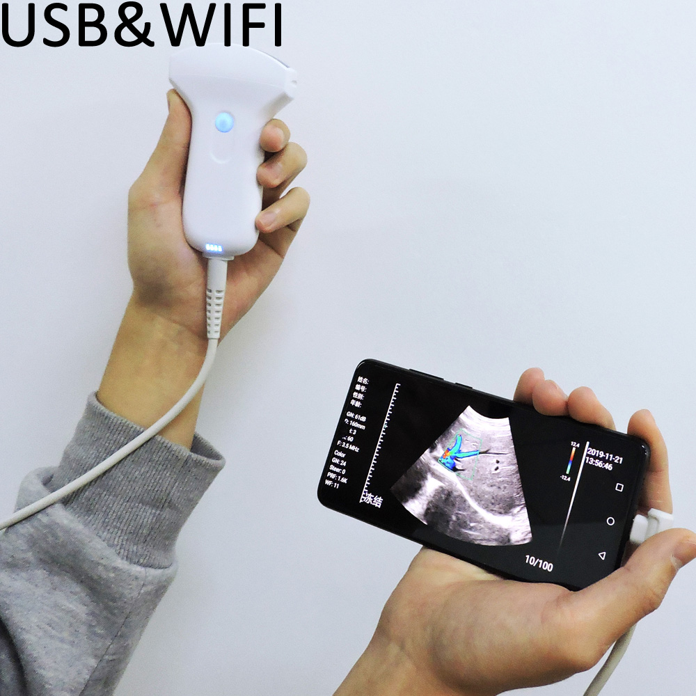 2020 новый USB ультразвук склонный как Wifi беспроводной ультразвуковой зонд