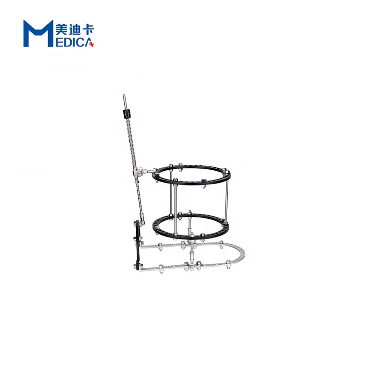 High quality orthopedic surgical implant ilizarov type knee joint external fixator for bone fracture treatment