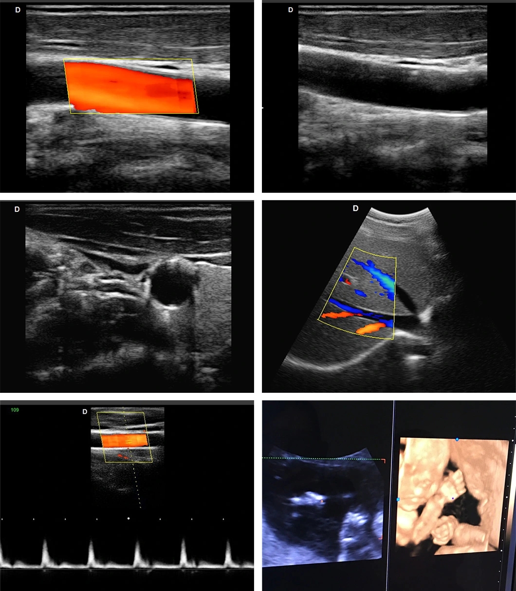 Customized color doppler 4d echo sonography ultrasound scanner machine ultrasound scanner 4D Volume probe