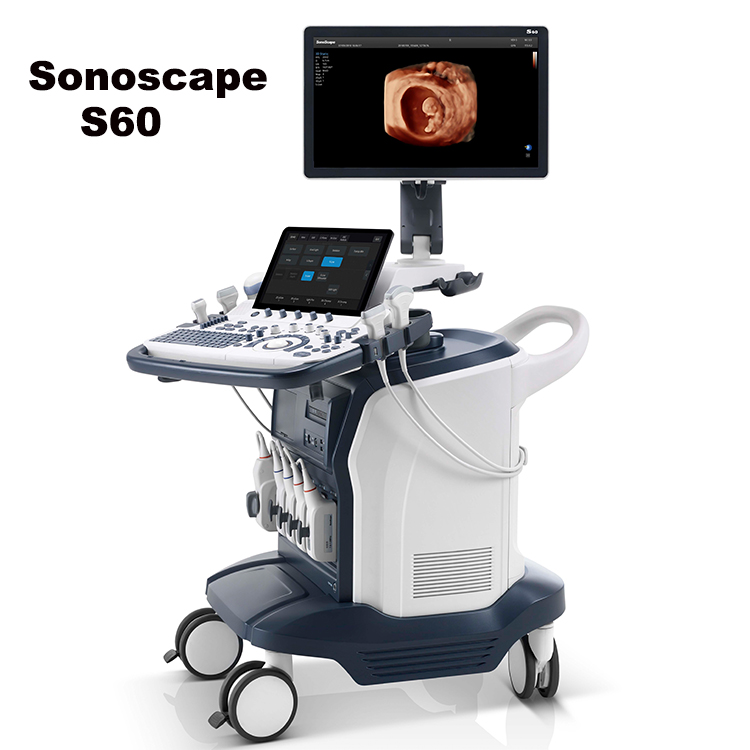 Новый дизайн, ультразвуковая машина Sonoscape Trolley для физиотерапии, Цветной Допплер