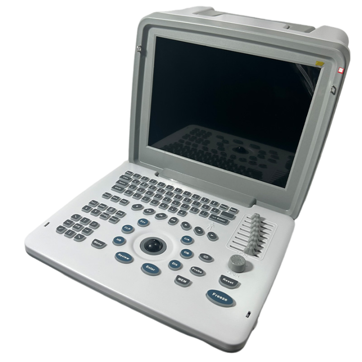 Wholesale Hospital Diagnostic Equipment Laptop High Quality Medical Convex Portable Lcd Ultrasound Scanner