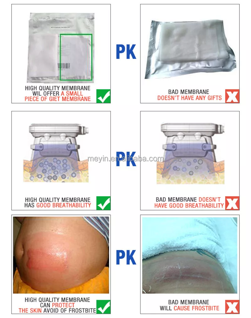 antifreeze membranes criolipolisis cryolipolysis antifreeze membrane