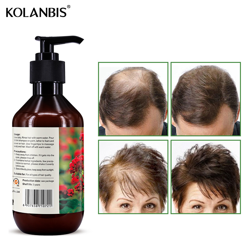 Kolanbis hair loss shampoo strengthen fast regrow product for women men wholesale private label