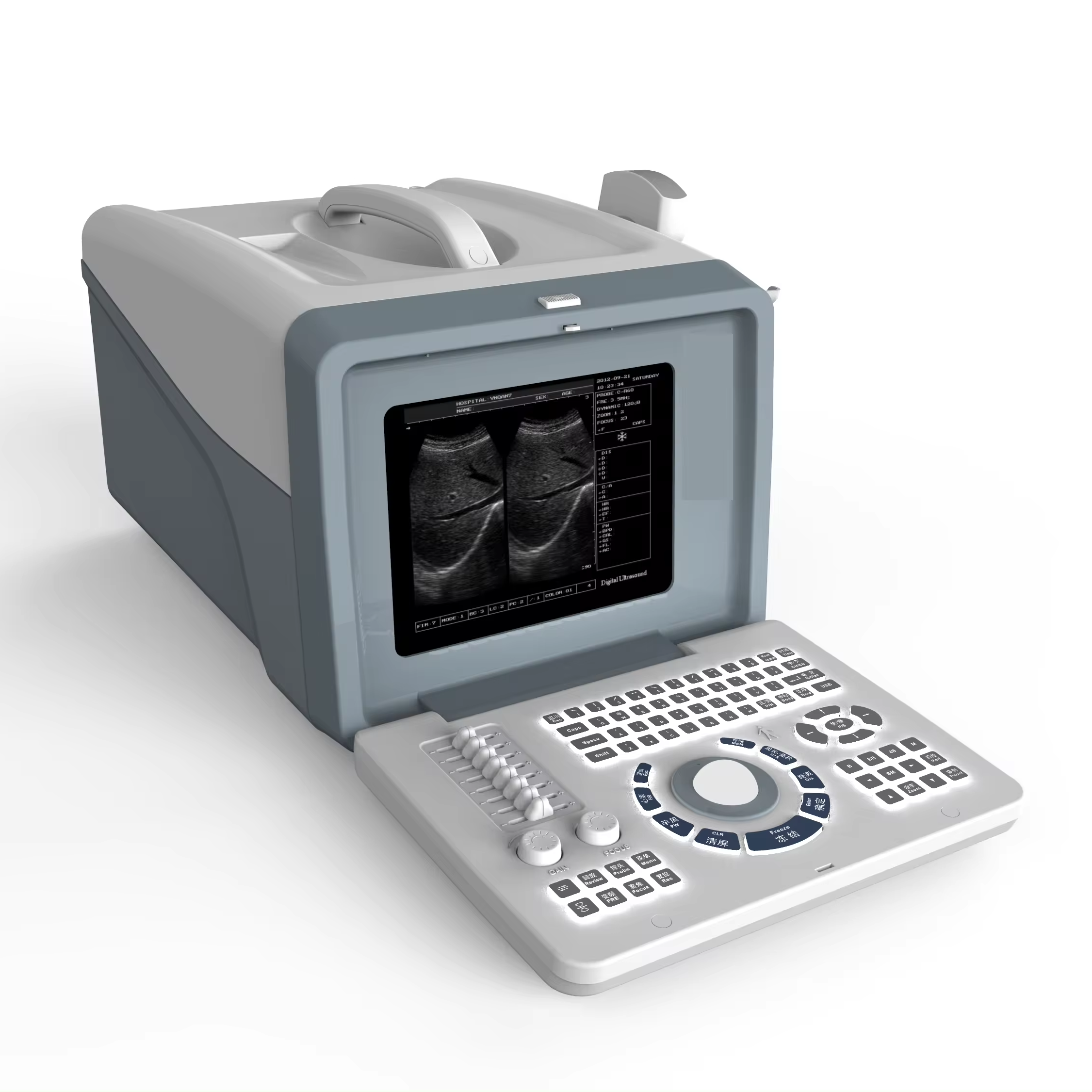 Best Price Portable Full Digital Doppler USG Ultrasonic System Easy Operation Medical Diagnostic Ultrasound Machine